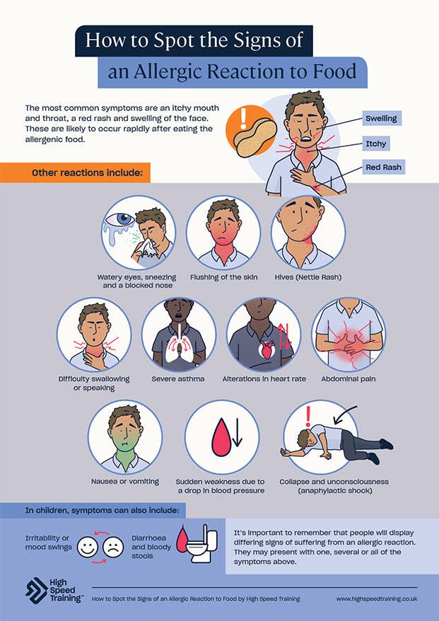 How to Spot the Signs of an Allergic Reaction to Food Poster