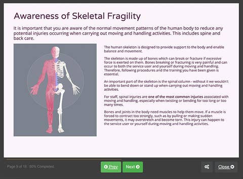 Course screenshot showing awareness of skeletal fragility